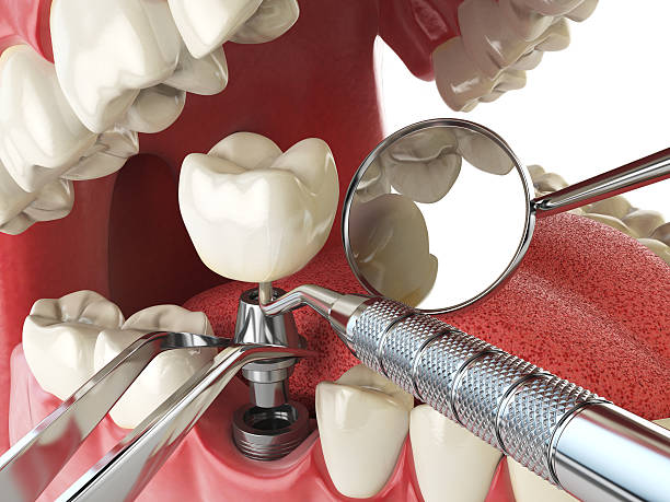 Best Urgent Dental Care in St Joseph, IL